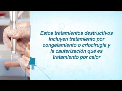 Precio de podofilox imiquimod