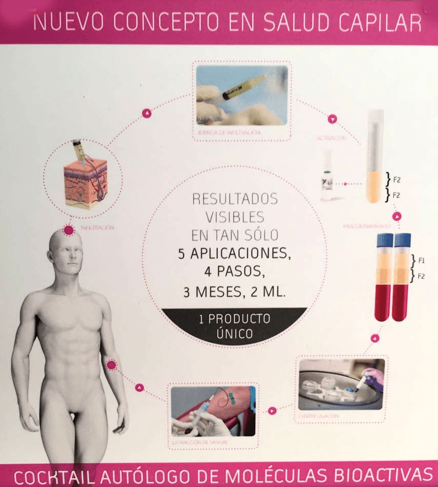 Sildenafil 50 mg en mujeres