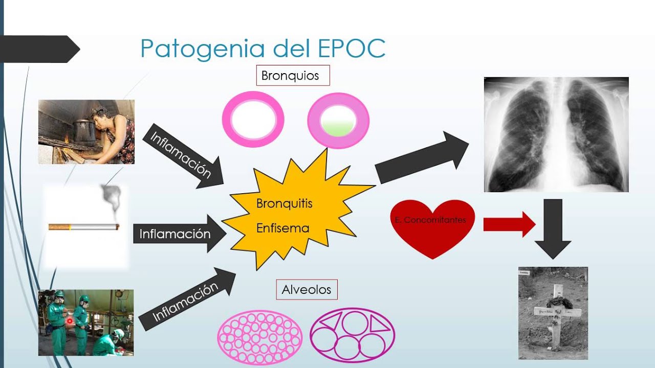 ordenar tapentadol en línea ordenar tapentadol en línea