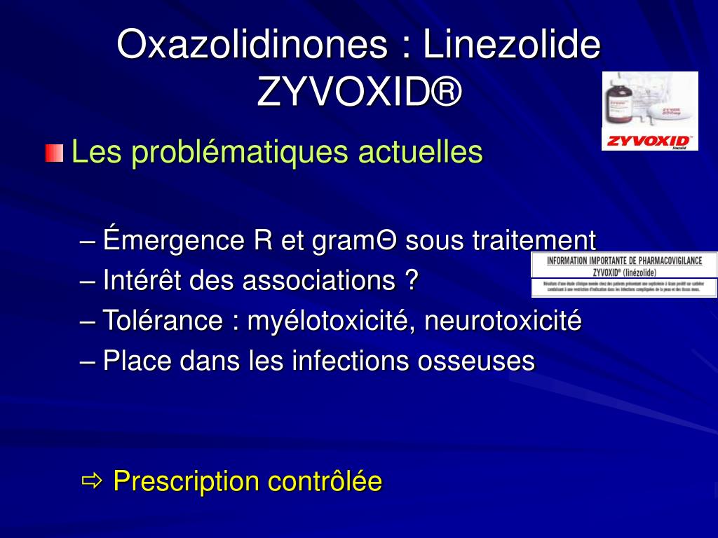 ivexterm on-line
