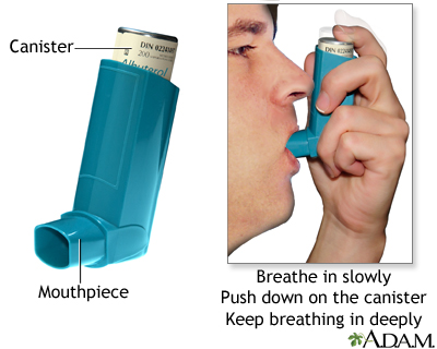 Salbutamol Inhaler Online