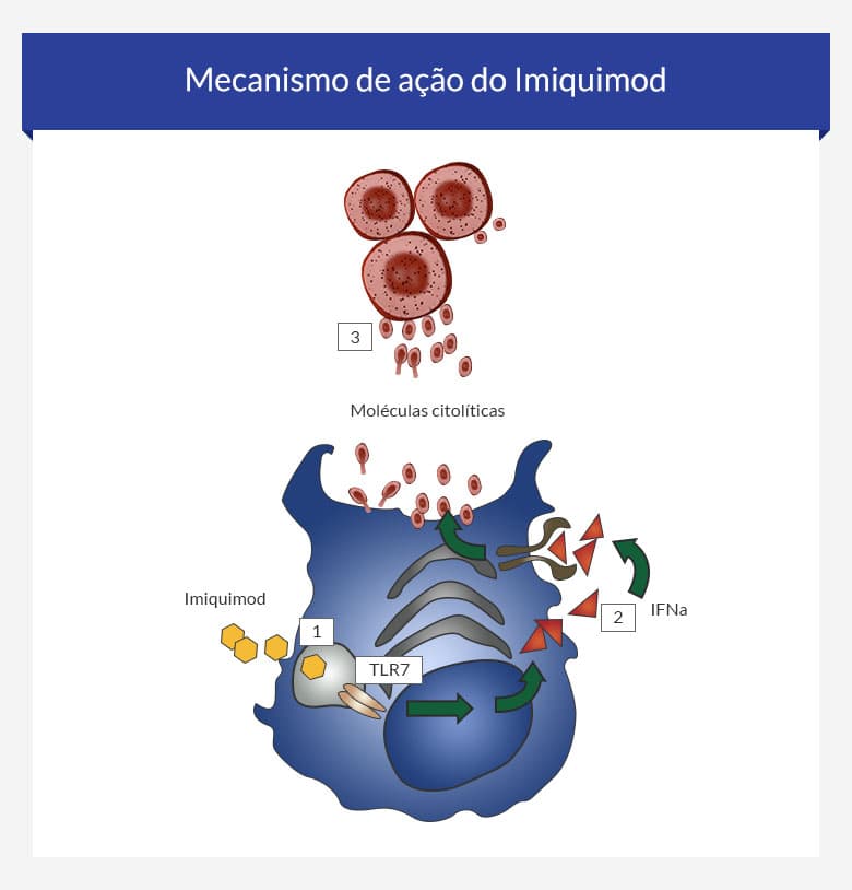 Ordenar Imiquimod En Línea