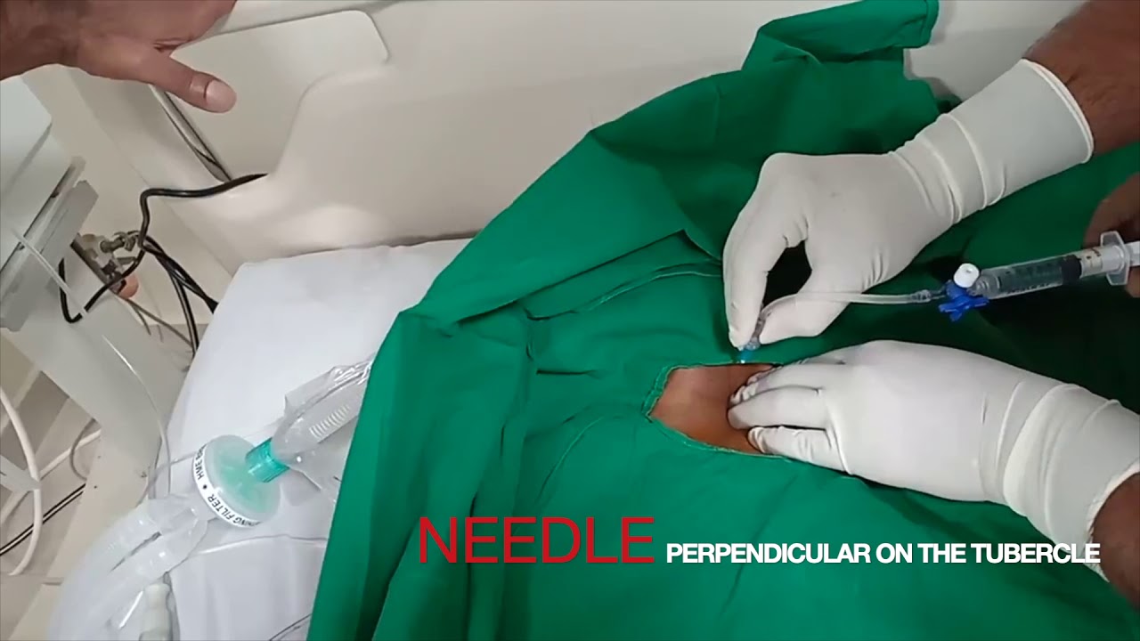 tramadol kilab precio